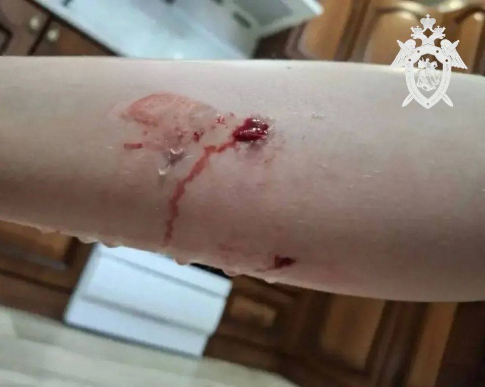В Минеральных Водах бездомные собаки напали на двух детей 8 и 9 лет В Минеральных Водах бездомные собаки напали на двух детей 8 и 9 лет