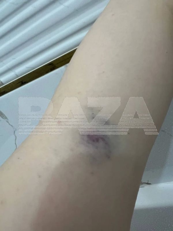 Россиянка полтора года выхаживала своего парня после страшной аварии, а когда он поправился — избил её, бросил и уехал с деньгами Россиянка полтора года выхаживала своего парня после страшной аварии, а когда он поправился — избил её, бросил и уехал с деньгами