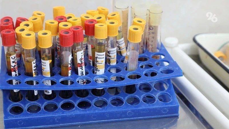 Показатель заболеваемости ВИЧ-инфекцией за год снизился на 4,6% на Ставрополье